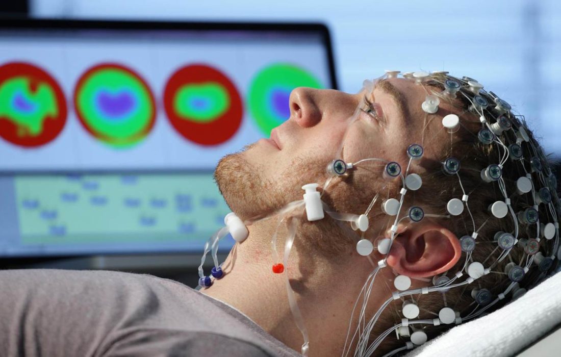 نقش دستگاه EEG در تشخیص اختلالات روانی