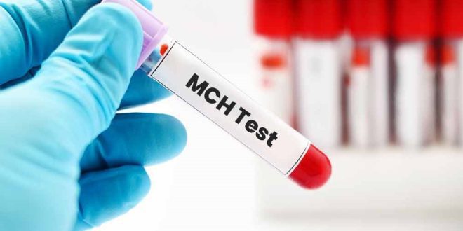 MCH در آزمایش خون و هر آنچه که باید درباره‌ آن بدانیم!