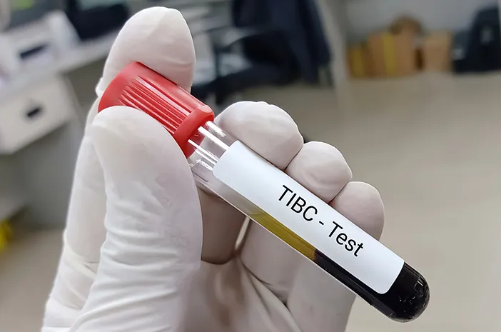 تفسیر آزمایش TIBC و عوارض پایین یا بالا بودن آن در خون