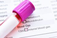 آزمایش گاز خون چیست؟