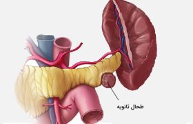 منظور از طحال فرعی چیست؟