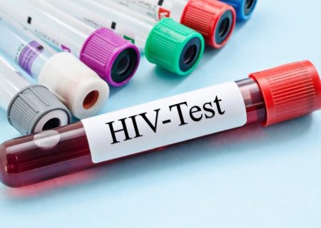 آزمایش ایدز (HIV)؛ راهنمای خواندن برگه آزمایش و تحلیل نتیجه آن