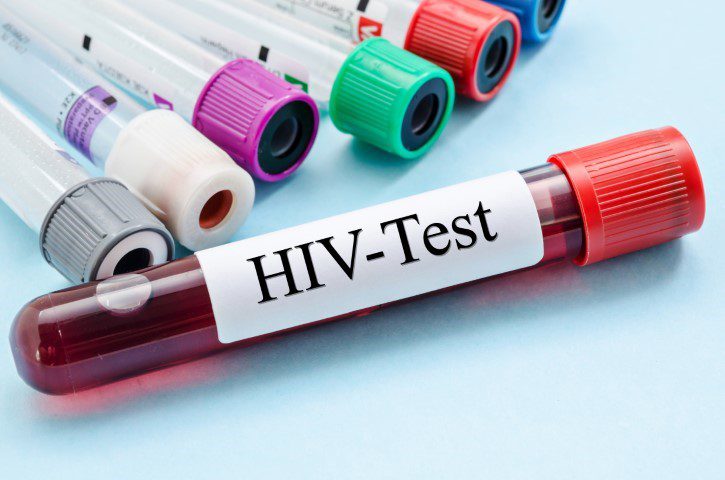 آزمایش ایدز (HIV)؛ راهنمای خواندن برگه آزمایش و تحلیل نتیجه آن