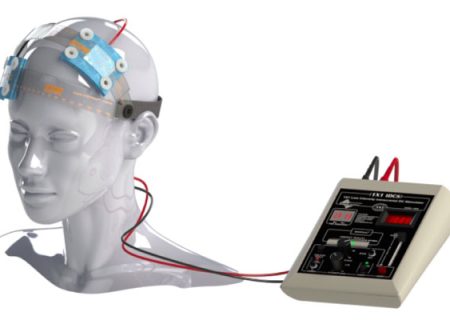 آیا درمان افسردگی با دستگاه TDCS ممکن است؟