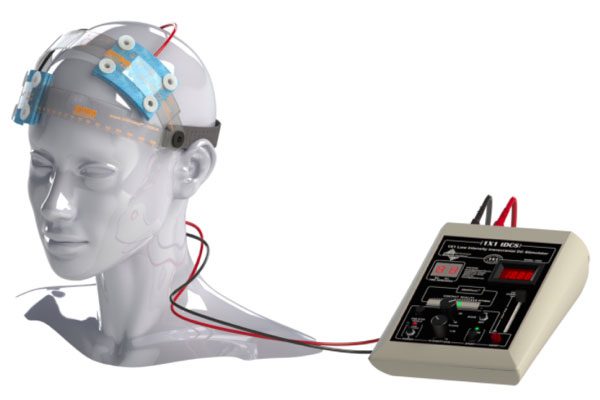 آیا درمان افسردگی با دستگاه TDCS ممکن است؟